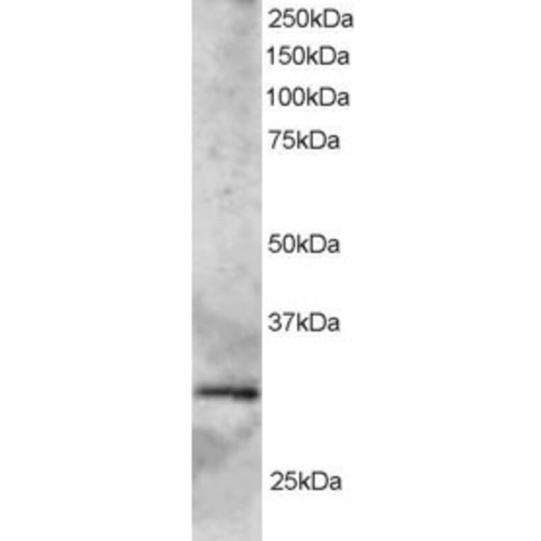 Western Blot - Anti-GCIP Interacting Protein p29 Antibody (A83276) - Antibodies.com