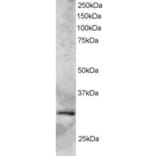 Western Blot - Anti-GCIP Interacting Protein p29 Antibody (A83276) - Antibodies.com