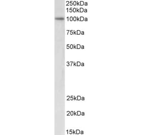 Western Blot - Anti-UHRF1 Antibody (A83277) - Antibodies.com