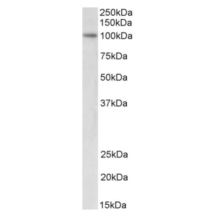 Western Blot - Anti-UHRF1 Antibody (A83277) - Antibodies.com