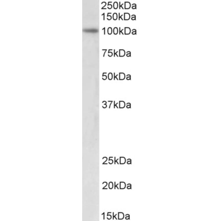 Western Blot - Anti-UHRF1 Antibody (A83277) - Antibodies.com