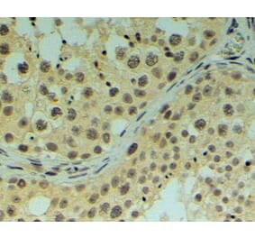 Immunohistochemistry - Anti-REV1 Antibody (A83278) - Antibodies.com