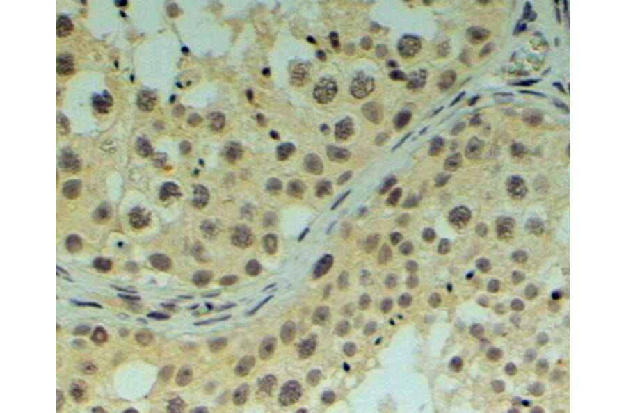 Immunohistochemistry - Anti-REV1 Antibody (A83278) - Antibodies.com