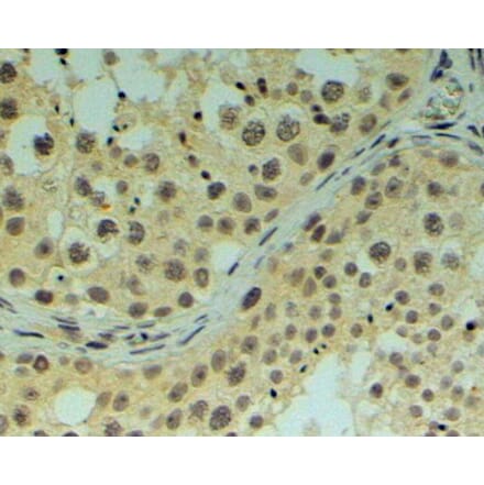 Immunohistochemistry - Anti-REV1 Antibody (A83278) - Antibodies.com