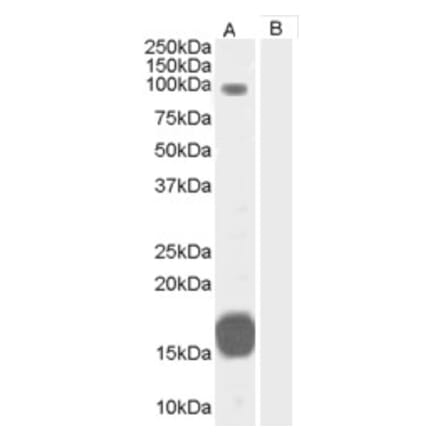 Western Blot - Anti-GRAF Antibody (A83279) - Antibodies.com