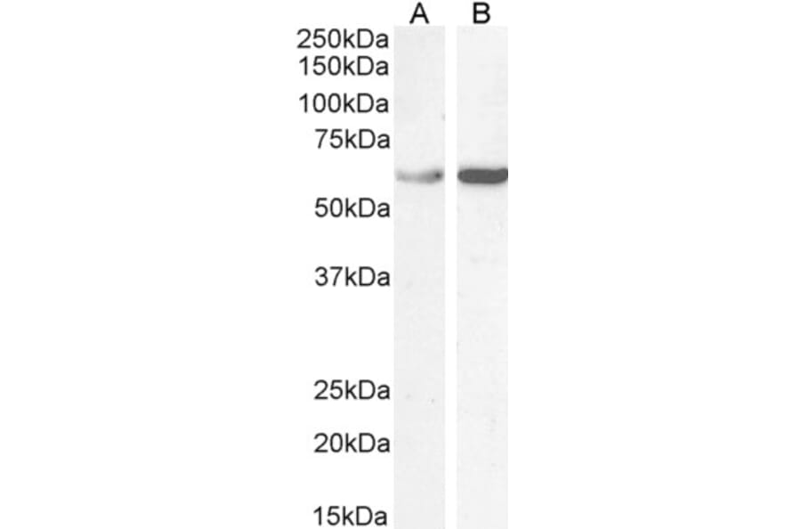 Western Blot - Anti-TCP1 alpha Antibody (A83280) - Antibodies.com