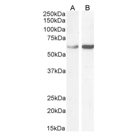 Western Blot - Anti-TCP1 alpha Antibody (A83280) - Antibodies.com