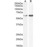 Western Blot - Anti-TCP1 alpha Antibody (A83280) - Antibodies.com