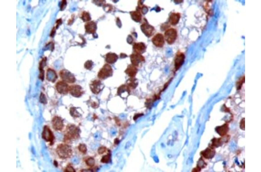 Immunohistochemistry - Anti-TCP1 alpha Antibody (A83280) - Antibodies.com