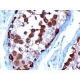 Immunohistochemistry - Anti-TCP1 alpha Antibody (A83280) - Antibodies.com