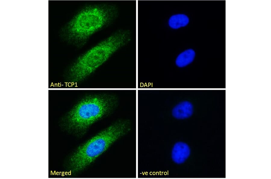 Immunofluorescence - Anti-TCP1 alpha Antibody (A83280) - Antibodies.com
