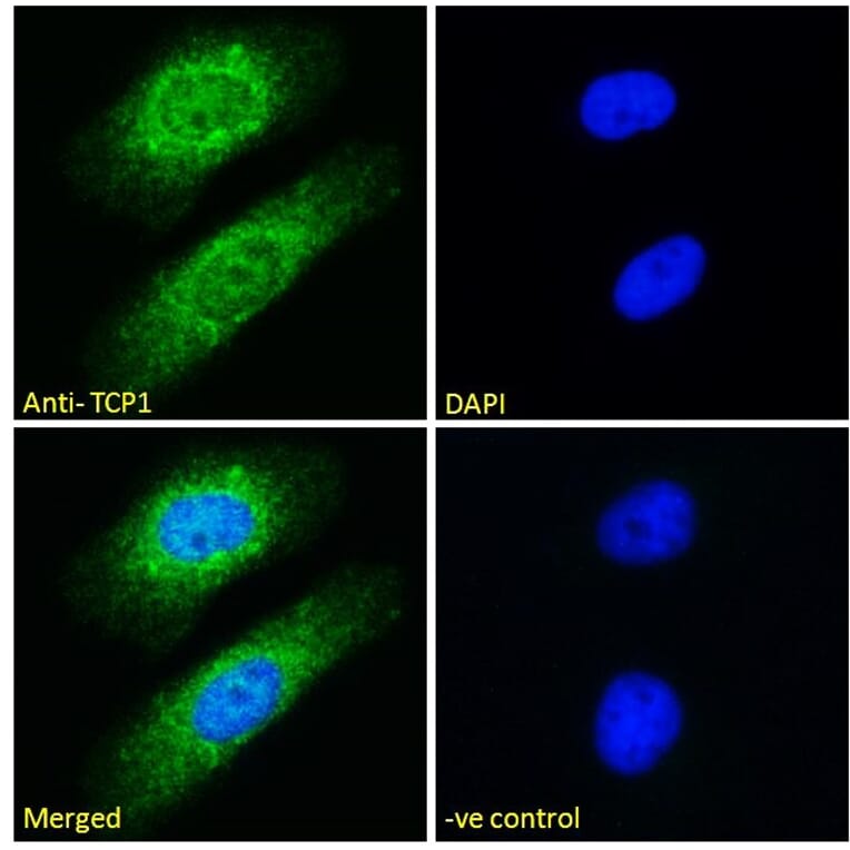 Immunofluorescence - Anti-TCP1 alpha Antibody (A83280) - Antibodies.com