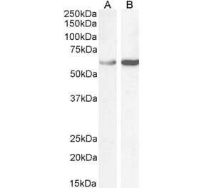 Western Blot - Anti-TCP1 Antibody (A83280)