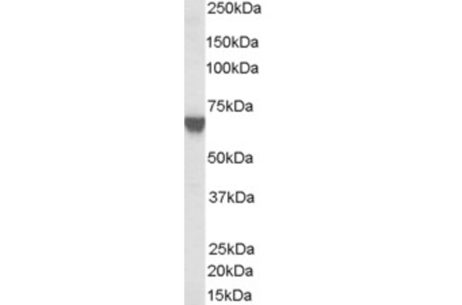 Western Blot - Anti-TOM1L2 Antibody (A83282) - Antibodies.com