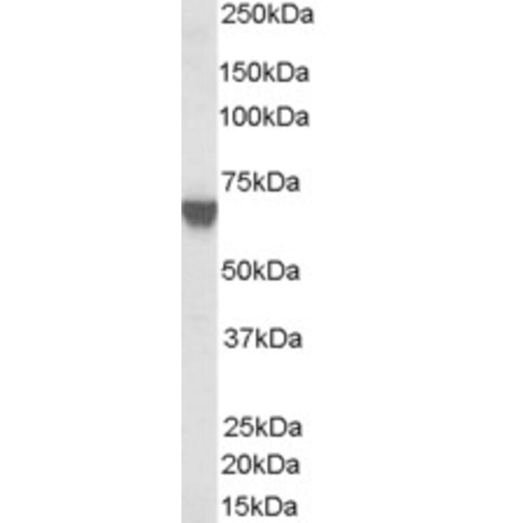 Western Blot - Anti-TOM1L2 Antibody (A83282) - Antibodies.com