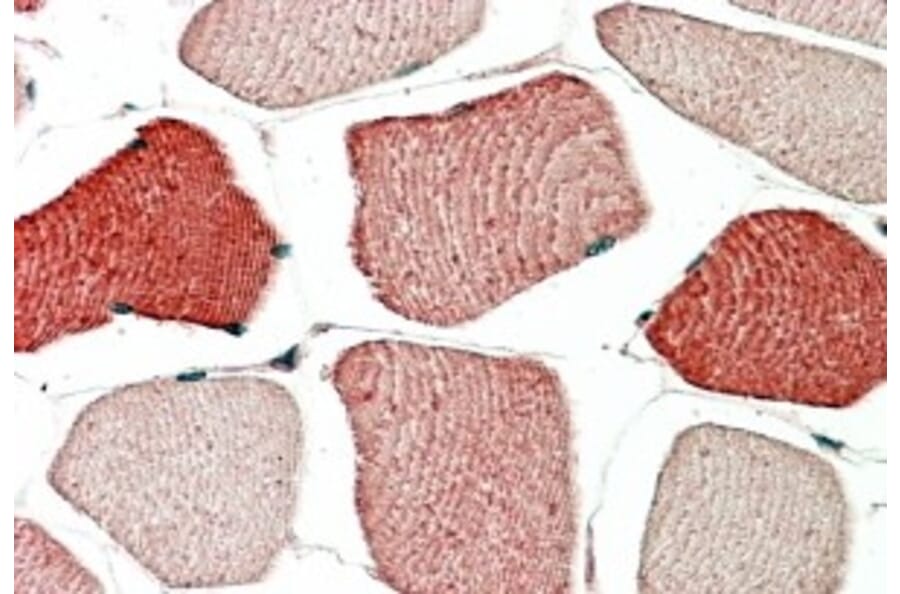 Immunohistochemistry - Anti-TOM1L2 Antibody (A83282) - Antibodies.com
