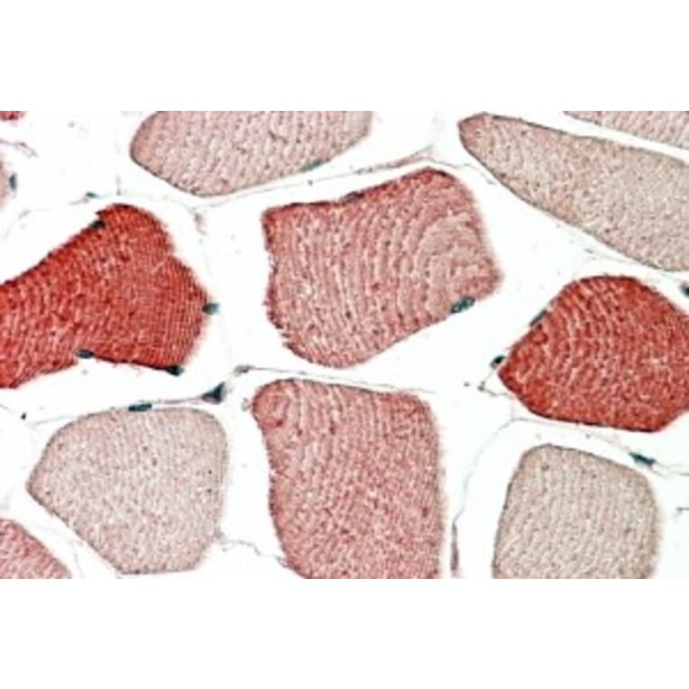 Immunohistochemistry - Anti-TOM1L2 Antibody (A83282) - Antibodies.com