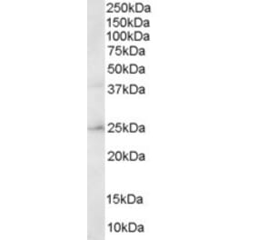 Western Blot - Anti-ERAB Antibody (A83283) - Antibodies.com