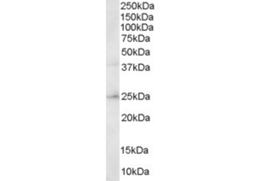 Western Blot - Anti-ERAB Antibody (A83283) - Antibodies.com