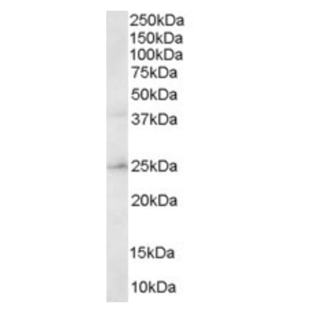 Western Blot - Anti-ERAB Antibody (A83283) - Antibodies.com