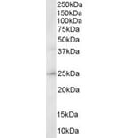 Western Blot - Anti-ERAB Antibody (A83283) - Antibodies.com