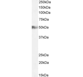 Western Blot - Anti-H2R Antibody (A83284) - Antibodies.com