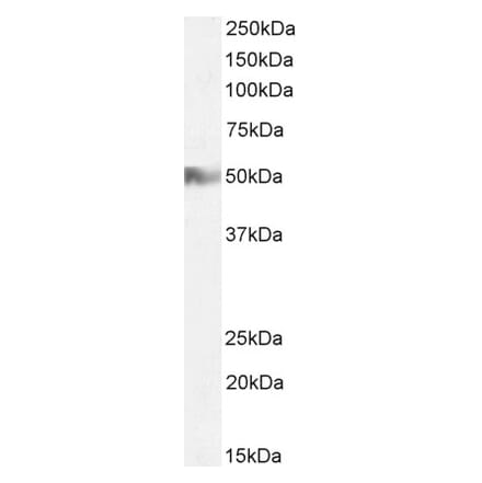 Western Blot - Anti-H2R Antibody (A83284) - Antibodies.com