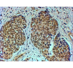 Immunohistochemistry - Anti-TRIM24 Antibody (A83286) - Antibodies.com