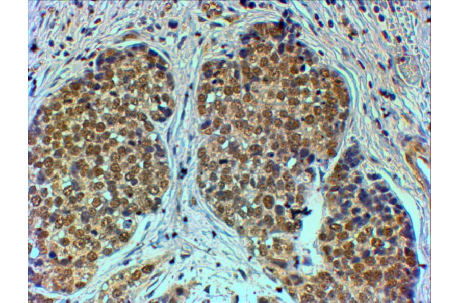 Immunohistochemistry - Anti-TRIM24 Antibody (A83286) - Antibodies.com