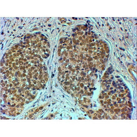 Immunohistochemistry - Anti-TRIM24 Antibody (A83286) - Antibodies.com