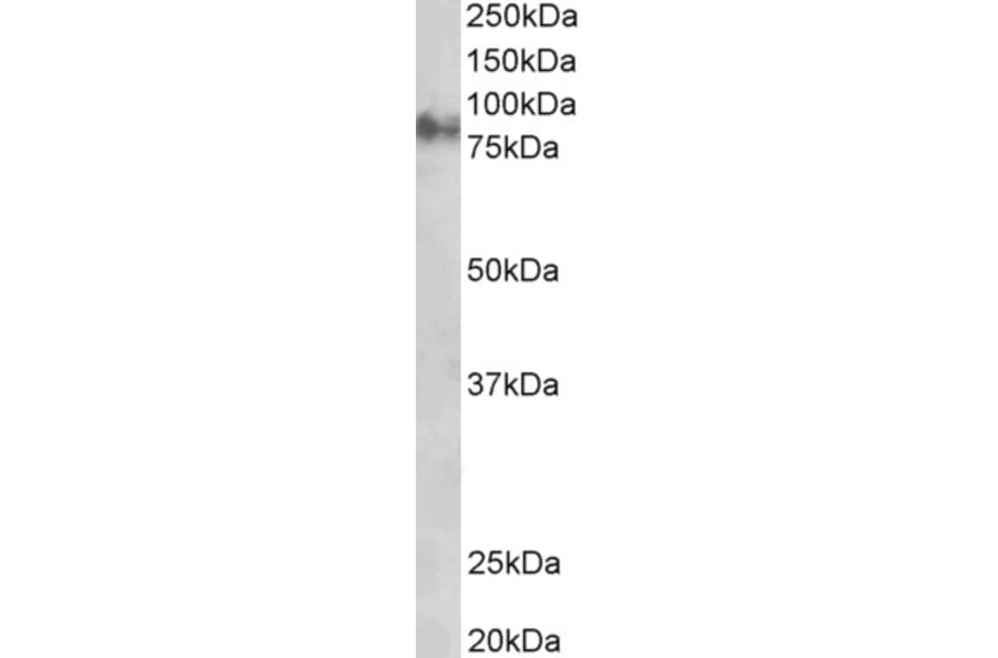 Western Blot - Anti-gamma Catenin Antibody (A83287) - Antibodies.com