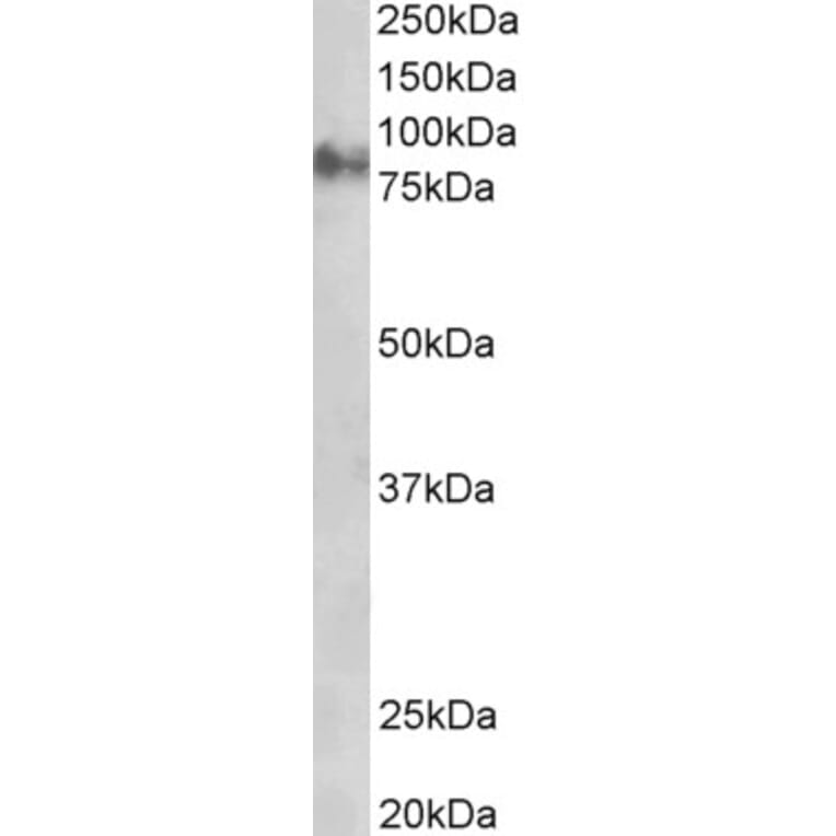 Western Blot - Anti-gamma Catenin Antibody (A83287) - Antibodies.com