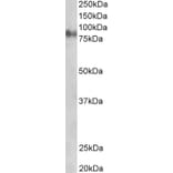 Western Blot - Anti-gamma Catenin Antibody (A83287) - Antibodies.com