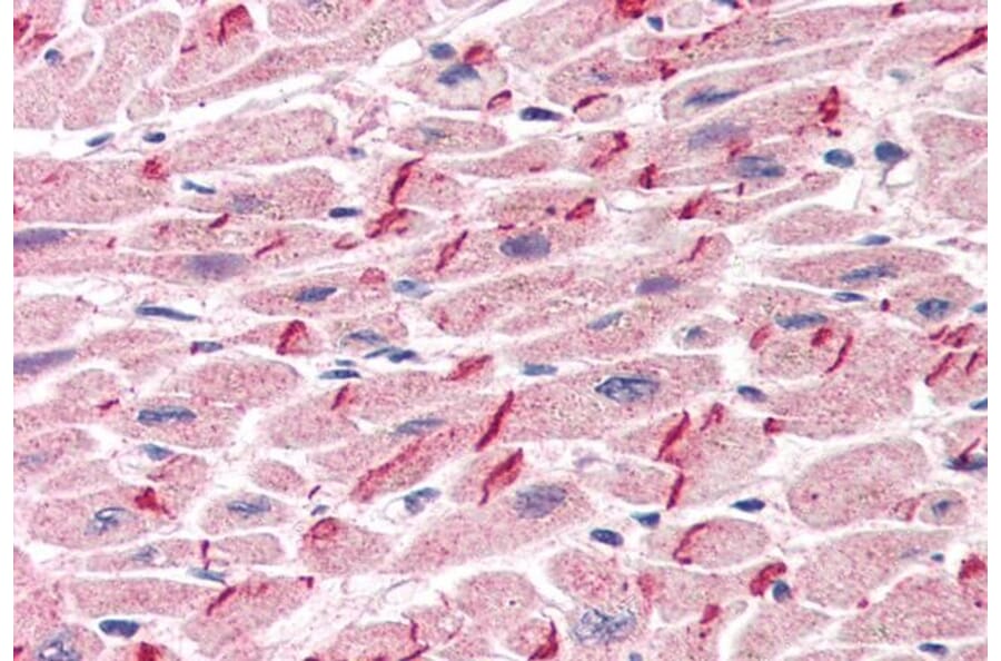Immunohistochemistry - Anti-gamma Catenin Antibody (A83287) - Antibodies.com
