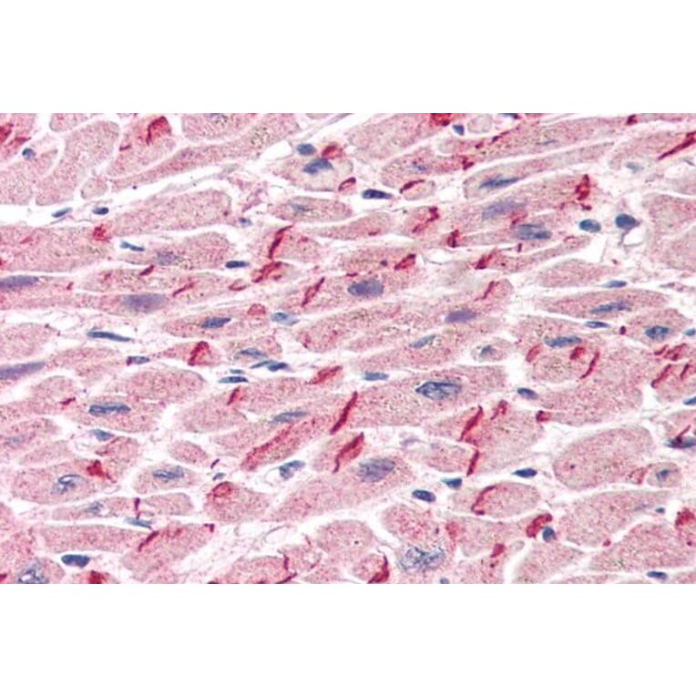 Immunohistochemistry - Anti-gamma Catenin Antibody (A83287) - Antibodies.com