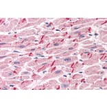 Immunohistochemistry - Anti-gamma Catenin Antibody (A83287) - Antibodies.com