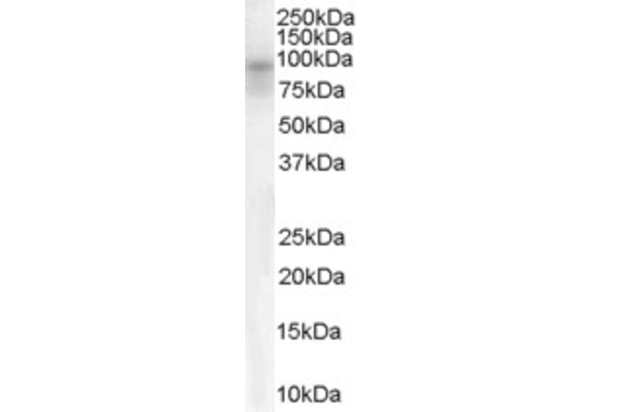 Western Blot - Anti-DPP10 Antibody (A83290) - Antibodies.com