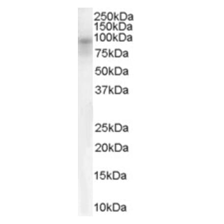 Western Blot - Anti-DPP10 Antibody (A83290) - Antibodies.com