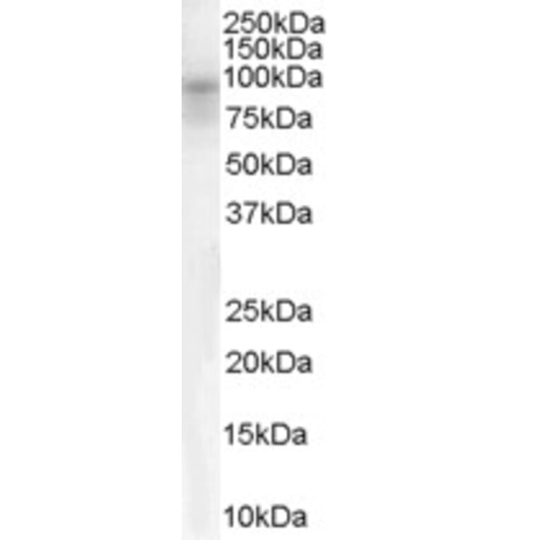 Western Blot - Anti-DPP10 Antibody (A83290) - Antibodies.com