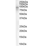 Western Blot - Anti-DPP10 Antibody (A83290) - Antibodies.com