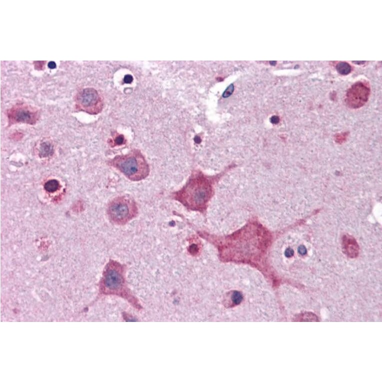 Immunohistochemistry - Anti-DPP10 Antibody (A83290) - Antibodies.com