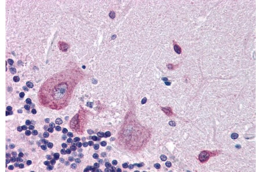 Immunohistochemistry - Anti-DPP10 Antibody (A83290) - Antibodies.com