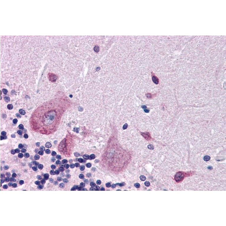 Immunohistochemistry - Anti-DPP10 Antibody (A83290) - Antibodies.com