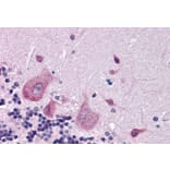 Immunohistochemistry - Anti-DPP10 Antibody (A83290) - Antibodies.com