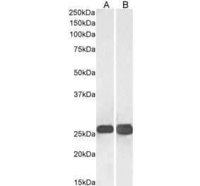 Western Blot - Anti-SNAP25 Antibody (A83291) - Antibodies.com