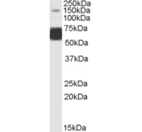 Western Blot - Anti-GluK1 Antibody (A83293) - Antibodies.com