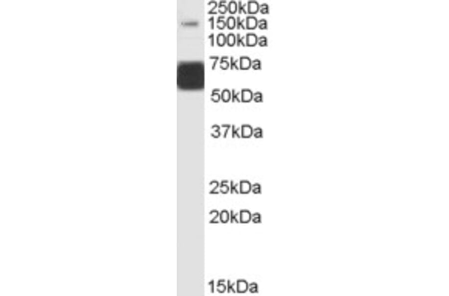 Western Blot - Anti-GluK1 Antibody (A83293) - Antibodies.com