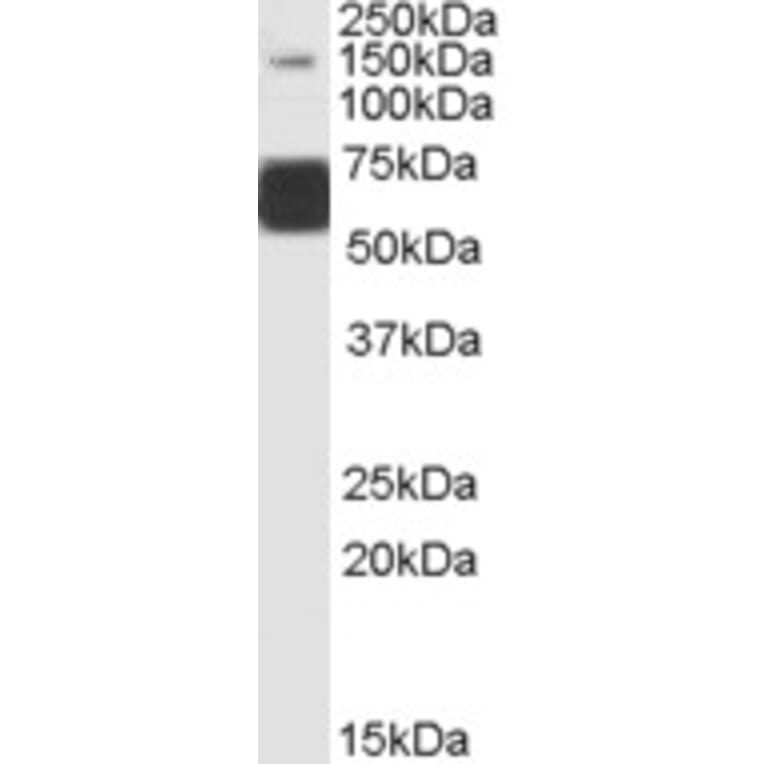 Western Blot - Anti-GluK1 Antibody (A83293) - Antibodies.com