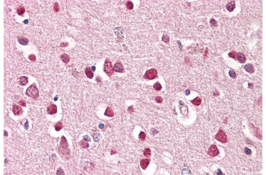 Immunohistochemistry - Anti-GluK1 Antibody (A83293) - Antibodies.com