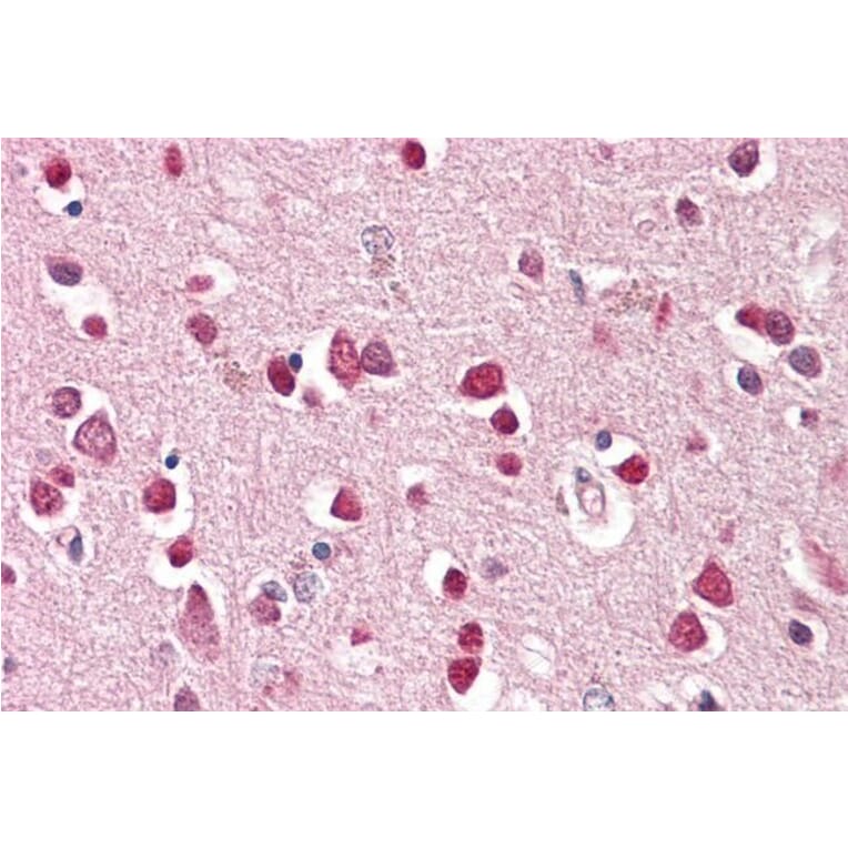 Immunohistochemistry - Anti-GluK1 Antibody (A83293) - Antibodies.com